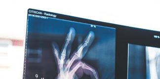 Australia: Intermediate Capital appoints Rothschild for radiology sale