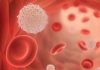 Sweden: AlgoDx closes seed funding for sepsis detection