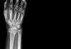 Israel: Nanox Imaging shares rocked by short-seller claims