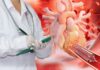 Hong Kong: Shanghai HeartCare to price HK$1.13bn IPO at top of range