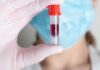 Denmark: Nygaard takes CEO seat at Glycorex Transplantation