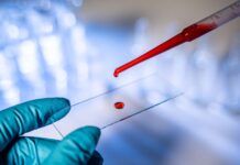 Spain: Eurofins to acquire Synlab’s clinical diagnostics operations in Spain
