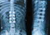 Malaysia: Quadria acquires majority stake in Straits Orthopaedics