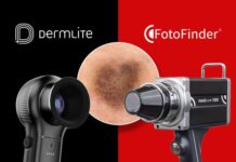 Germany: EMZ portfolio company FotoFinder Systems agrees to acquire DermLite