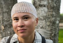 Switzerland: Novocure secures non-dilutive funding from Pharmakon