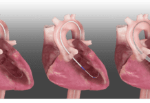 Israel: Magenta Medical closes US$105m financing led by Novo Holdings