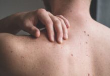 UK: Palatine takes majority stake in The MOLE Clinic