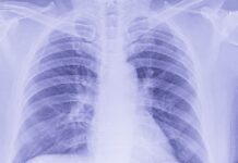 Belgium: Banook expands geographic reach and technological offering with acquisition of Fluidda
