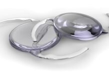 Switzerland: Alcon agrees best and final offer with STAAR Surgical