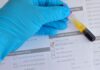 France: bioMérieux completes its offering for cell and gene therapies with acquisition of Accellix