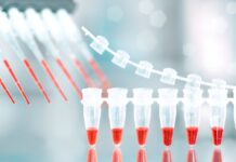France: Vivo Cap makes first buyout in Europe taking Dutscher from LBO France