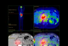 Spain: Archimed acquires Spanish PET radiopharmaceutical laboratory IRAB