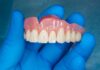 Spain: Alantra strengthens Aivoriq dental lab platform with two new acquisitions